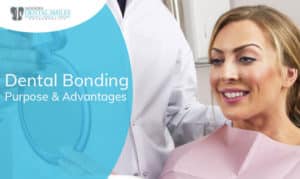 Dental Bonding