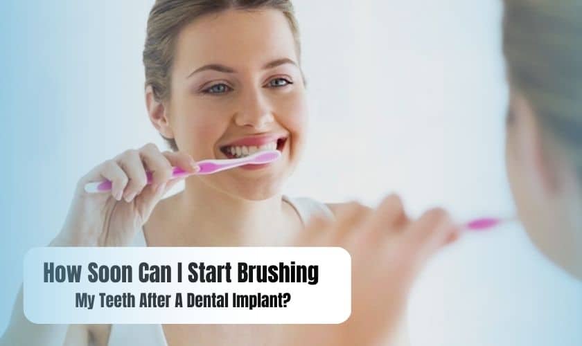 How Soon Can I Start Brushing My Teeth After A Dental Implant?