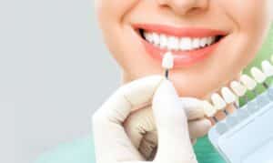 The Art And Science Behind Dental Veneers In Boynton Beach - Modern Dental Smiles