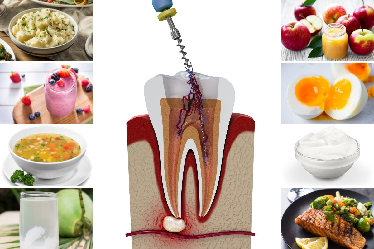 Best Foods To Eat After Root Canal Treatment