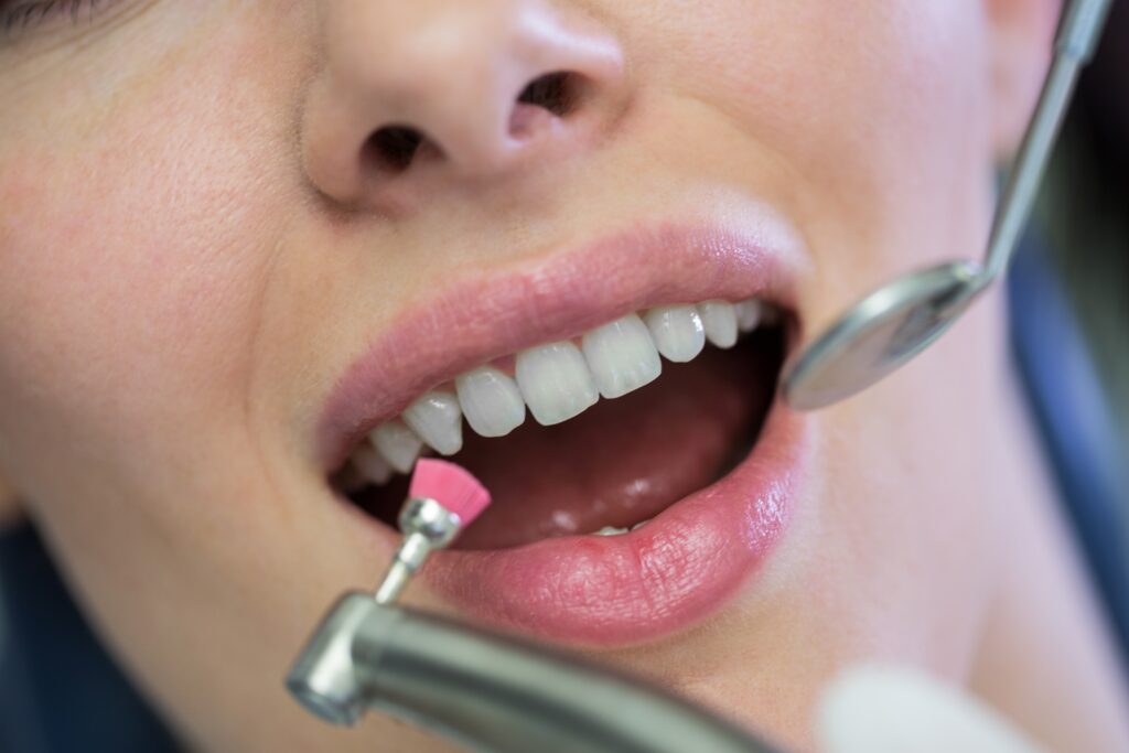 dental exams and cleanings in Florida